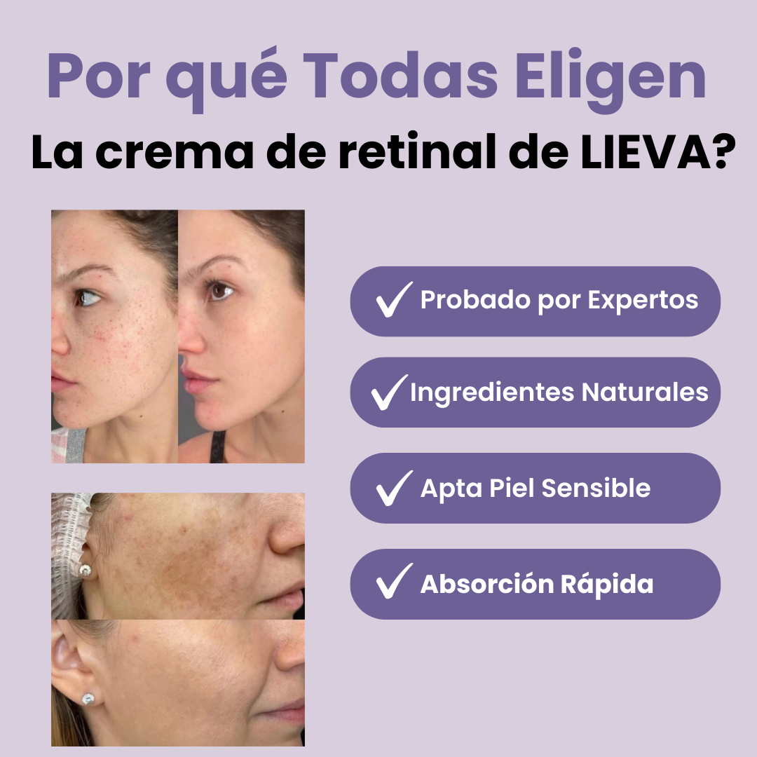 Lieva® - Crema Aclaradora