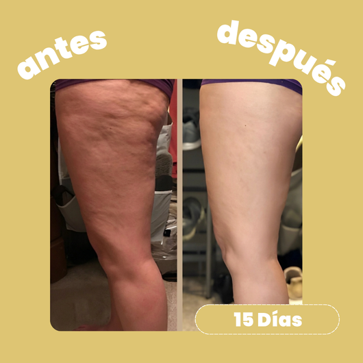 Crema Anticelulítica Reafirmante